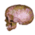 pri