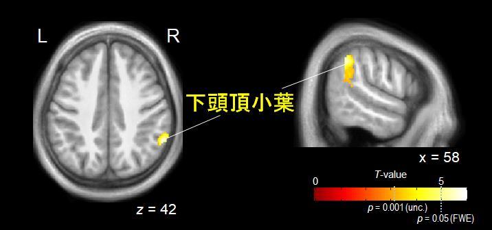 図２同数判断を行っているときと比べて同時性判断を怒っているときに強い活動をし示した部位.jpg